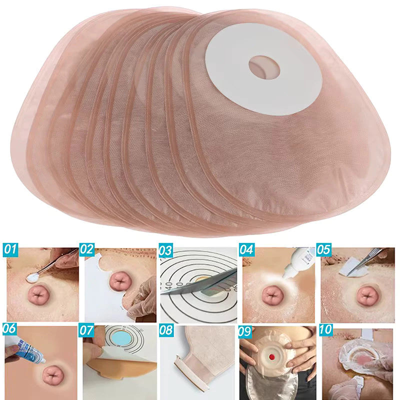 Bolsa de Colostomia Descartável 1 Peça com Barreira Hidrocoloide – Kit 10 Unidades Viva Secura